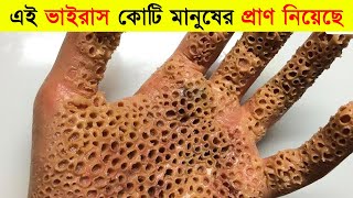 পৃথিবীর সবচেয়ে ভয়ংকর ১০ মহামারী  Top 10 Worst pandemics in History [upl. by Reed]