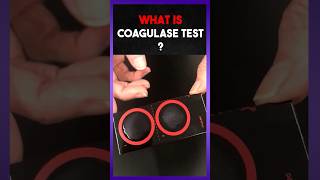 Coagulase Test  Clear explain [upl. by Rizzo]