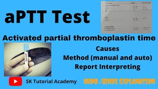 Activated partial thromboplastin time  aPTT test [upl. by Nylloh]