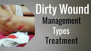 Management of Dirty Wound  Surgeon Dr Imtiaz Hussain [upl. by Allicerp]