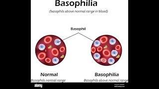 Basophilia Symptoms and Causes  Diagnosis  Treatment  Prevention [upl. by Theresina]