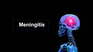 Meningitis [upl. by Atilrac]