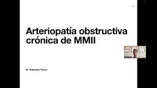 Arteriopatía Obstructiva Crónica MMII  Pregrados [upl. by Enifesoj]