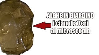 🚨🚨 Alghe nell’erba I cianobatteri al microscopio 🔬 [upl. by Doomham]