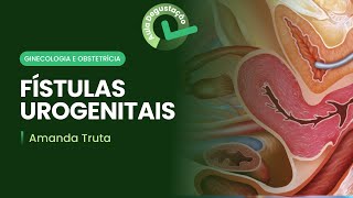 Fístulas urogenitais  Cortes de aula Ginecologia e obstetrícia [upl. by Gerianne353]