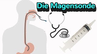 Alles wissenswerte zur Magensonde [upl. by Nilloc]