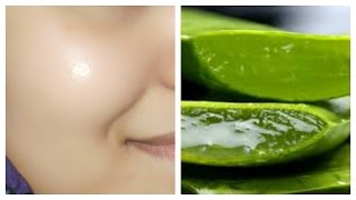 How to get clear glowing spotless skin by using aloe Vera gel [upl. by Eniamirt529]