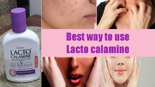 Lecto Calamine Lotion UsesBest 5 Way to Use On SkinNo More Dry pigmentedItcy Skin [upl. by Matthaus281]