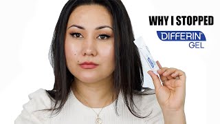 WHY I STOPPED USING DIFFERIN GEL  ADAPALENE GEL 01 ACNE TREATMENT  Zulayla [upl. by Marcile]