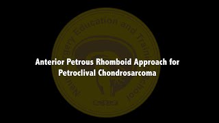 Anterior Petrous Rhomboid Approach for Petroclival Chondrosarcoma [upl. by Elletnwahs326]