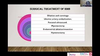 Endometriosis An Enigma  SS 29 [upl. by Lowndes179]