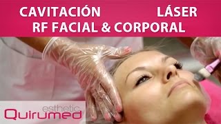 Cavitación  Radiofrecuencia Facial y Corporal  Láser [upl. by Torrell407]