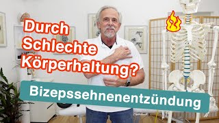 Bizepssehnenentzündung ⚡ Durch schlechte Körperhaltung  Übungen und Tipps [upl. by Nanoc]