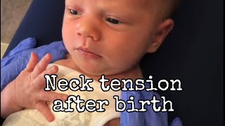 Neck tension after birth [upl. by Airehs]