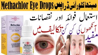 Methachlor Eye Drops PriceUsesBenefitsSide Effects Redness of Eye Swelling in eye [upl. by Esenwahs]