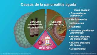 Pancreatitis aguda [upl. by Deni]