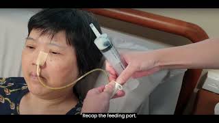 3 Performing Nasogastric Tube NGT Feeding [upl. by Sutherlan]