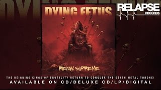 DYING FETUS  quotSubjected to a Beatingquot [upl. by Ana]