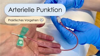 Arterielle Punktion  Schritt für Schritt Allen Test arterielle BGA Aradialis Tipps und Tricks [upl. by Euqinahs]