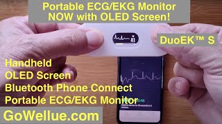 Wellue Portable ECGEKG Hand Held Monitor with OLED Screen formerly DuoEK™ S  Unboxing amp Review [upl. by Lohrman]