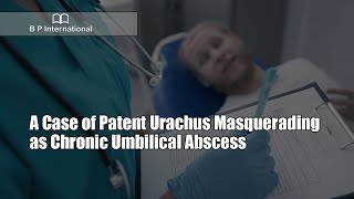 A Case of Patent Urachus Masquerading as Chronic Umbilical Abscess [upl. by Analise]