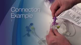 ENFit™ Transition Connector Demonstration [upl. by Padraic]