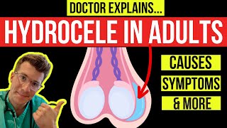 What is a HYDROCELE Doctor explains causes symptoms and treatment including surgery [upl. by Lerad]