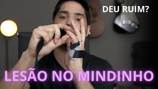 Luxação no Mindinho Minha Experiência e Dicas [upl. by Nhtanhoj]