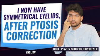 The Best treatment Options for Droopy Eyelids Ptosis  Patient experience  Ptosis treatment [upl. by Blainey]