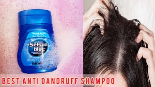 Selsun Blue Shampoo Review  Best Anti Dandruff Shampoo [upl. by Peck221]