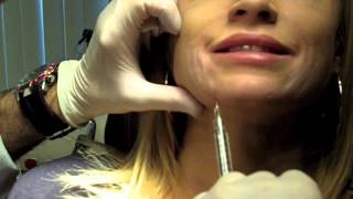 Cannula Method for Fillers  Dr Nissan Pilest Irvine CA [upl. by Tteraj]