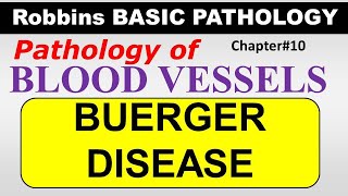 Ch10  BUERGER DISEASE  Blood Vessel Pathology  Robbins Lectures [upl. by Bergen]