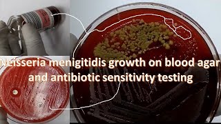 Neisseria menigitidis growth on blood agar and antibiotic sensitivity test [upl. by Lener]