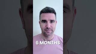 FUE HAIR TRANSPLANT 12 MONTHS RESULT  SMILE HAIR CLINIC [upl. by Iggep]