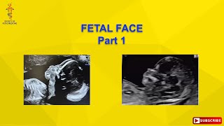 Fetal Face Part 1 [upl. by Kate]