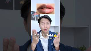 BIBIR HITAM  Wajib Pake Lip Serum GAMAL 🔥  lipcare [upl. by Elam38]