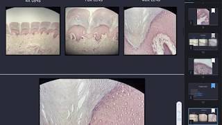 Keratinized stratified nonkeratinized stratified and transitional epithelium [upl. by Marsland]