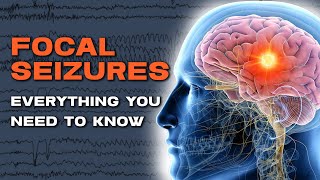 The Truth About Focal Automatism Seizures [upl. by Finah6]