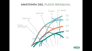 Lesion plexo braquial  raíces C5C6C7 [upl. by Ades291]