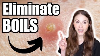 How To Get Rid Of Boils  Dermatologist Tips [upl. by Hacker]