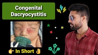 Congenital Dacryocystitis Lecture opthalmology [upl. by Nawiat]