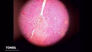 Lymphatic Systems Histology Slide Preview  Microscopic View  Anatomy [upl. by Eittel147]