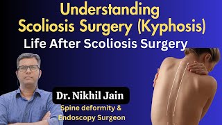 Understanding Scoliosis Surgery Kyphosis amp Life After Surgery  Dr Nikhil Jain [upl. by Delmar534]