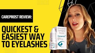 Careprost Review Quickest amp Easiest Way To Eyelashes [upl. by Lunseth]