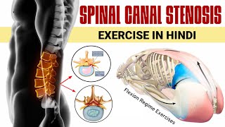 Spinal canal stenosis exercises in hindi  6 best lumbar canal stenosis exercises in hindi [upl. by Arob380]