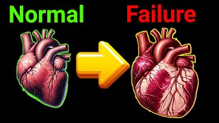 5 Early signs of Heart Failure  Congestive Heart Failure [upl. by Luby]