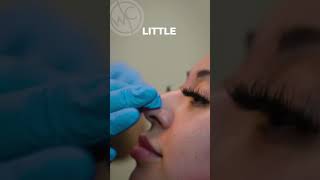 Transform your nose without surgery [upl. by Ednew]