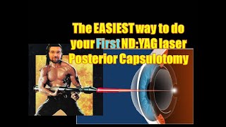 EASIEST way to do your First Nd YAG laser Posterior Capsulotomy ليزر المحفظة الخلفية لعدسة العين [upl. by Korenblat]