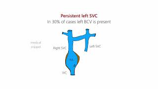 Persistent Left Superior Vena Cava Left SVC  Embryology and Clinical Anatomy [upl. by Pufahl736]