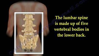 Lumbar Spinal Canal Stenosis lowback pain  Everything You Need To Know  Dr Nabil Ebraheim [upl. by Dacie]